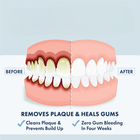 Gel Toothpaste – Mild Peppermint, Non-Foaming Formula