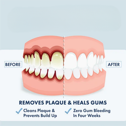 Gel Toothpaste – Mild Peppermint, Non-Foaming Formula