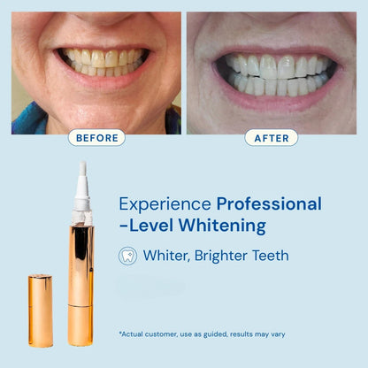 Teeth Whitening Gold Serum Pen – Dual-Peroxide with Xylitol